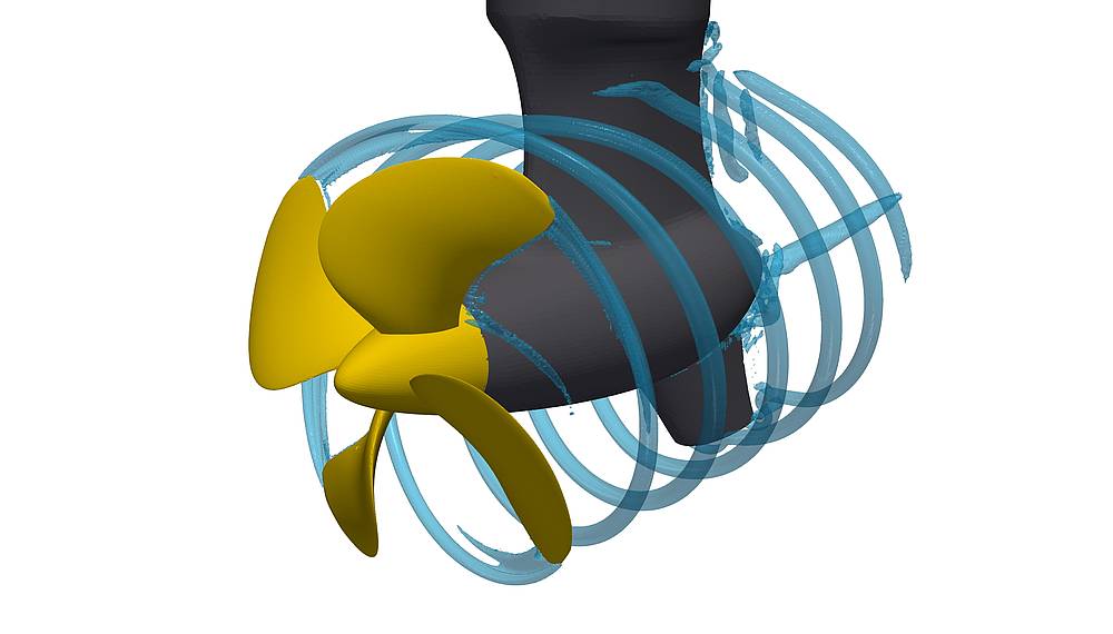 CFD simulation of a SCHOTTEL EcoPeller (SRE) at 21 knots: loss-generating flow zones, such as vortex areas, can be identified and subsequently minimized using CFD.